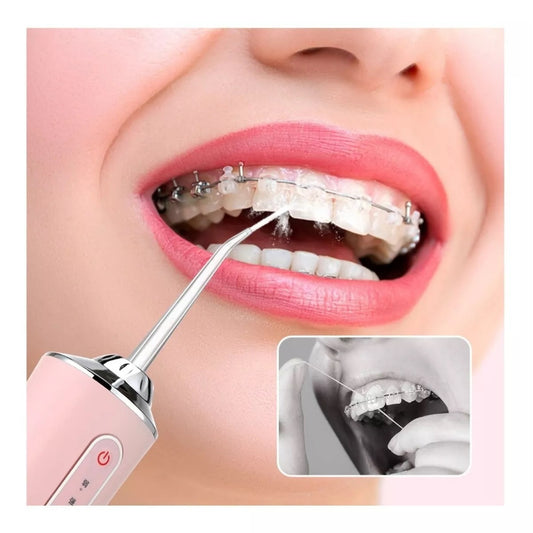 NUEVO IRRIGADOR ORAL PRO X30